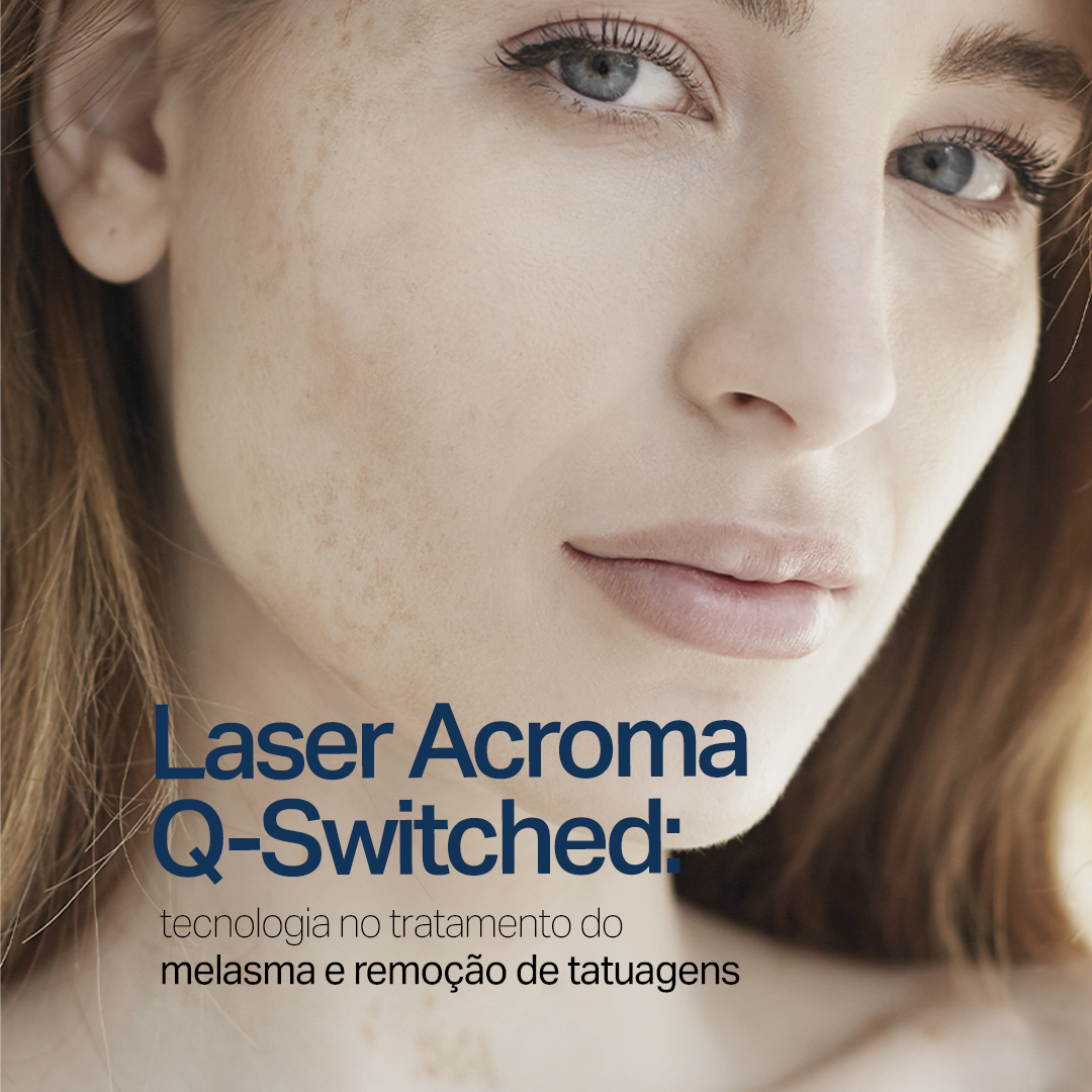 Laser Para Manchas Escuras Dra Sumaya M Ttar Dermatologista