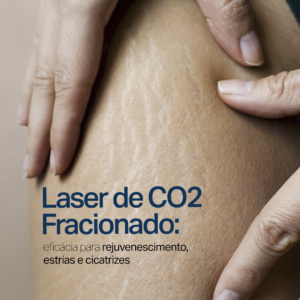 Sumaya Máttar Dermatologista - Laser CO2 Rejuvenescimento de Estrias e Cicatrizes