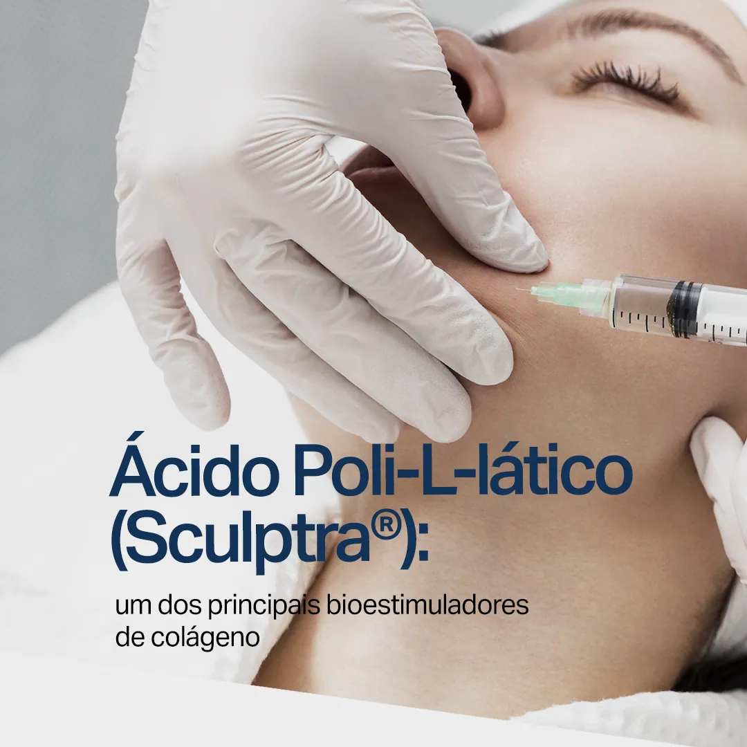 Sumaya Máttar Dermatologista - Juiz de Fora, MG - Tratamento Ácido Poli-L-Lático (Sculptra®)