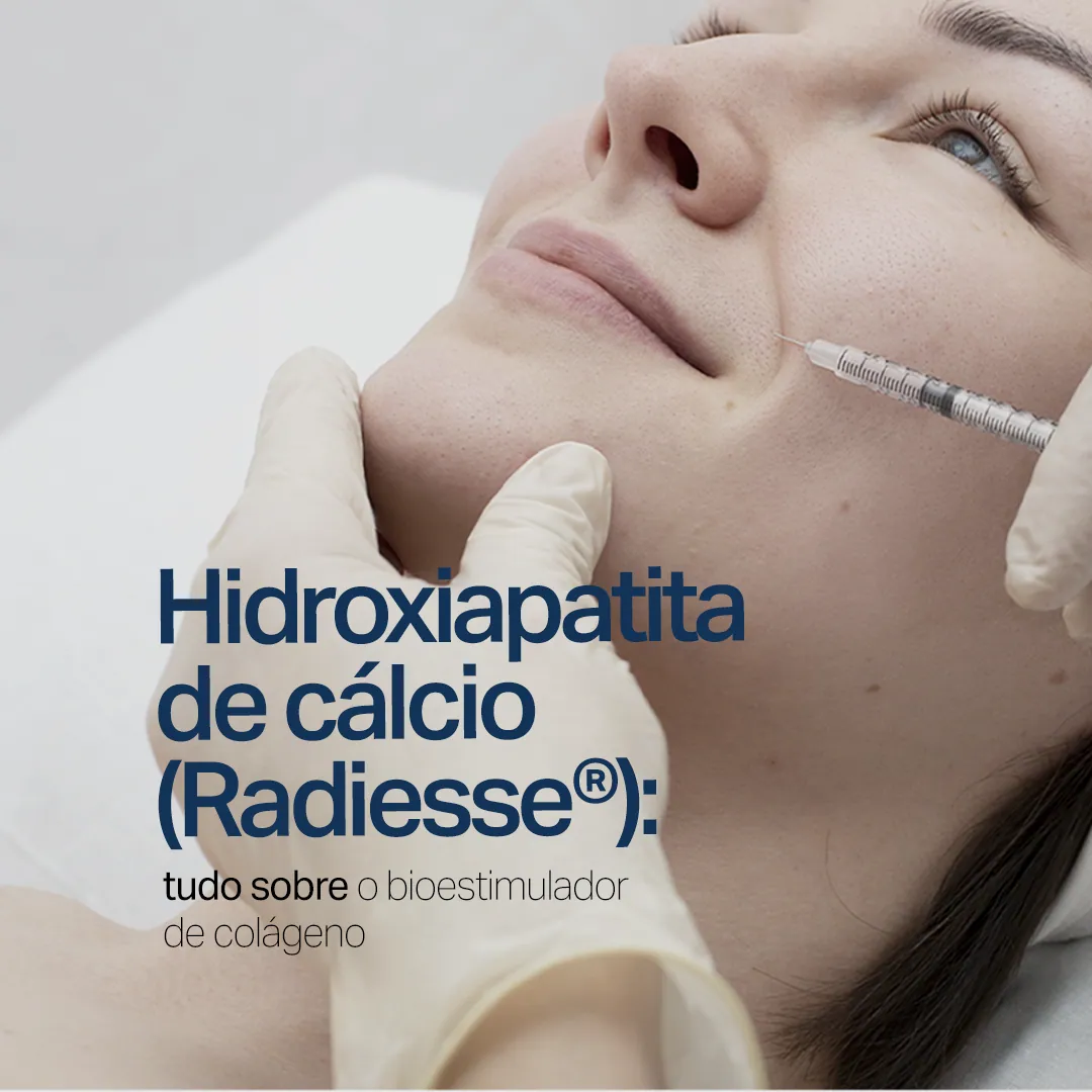 Sumaya Máttar Dermatologista - Juiz de Fora, MG - Tratamento Hidroxiapatita de Cálcio (Radiesse®)