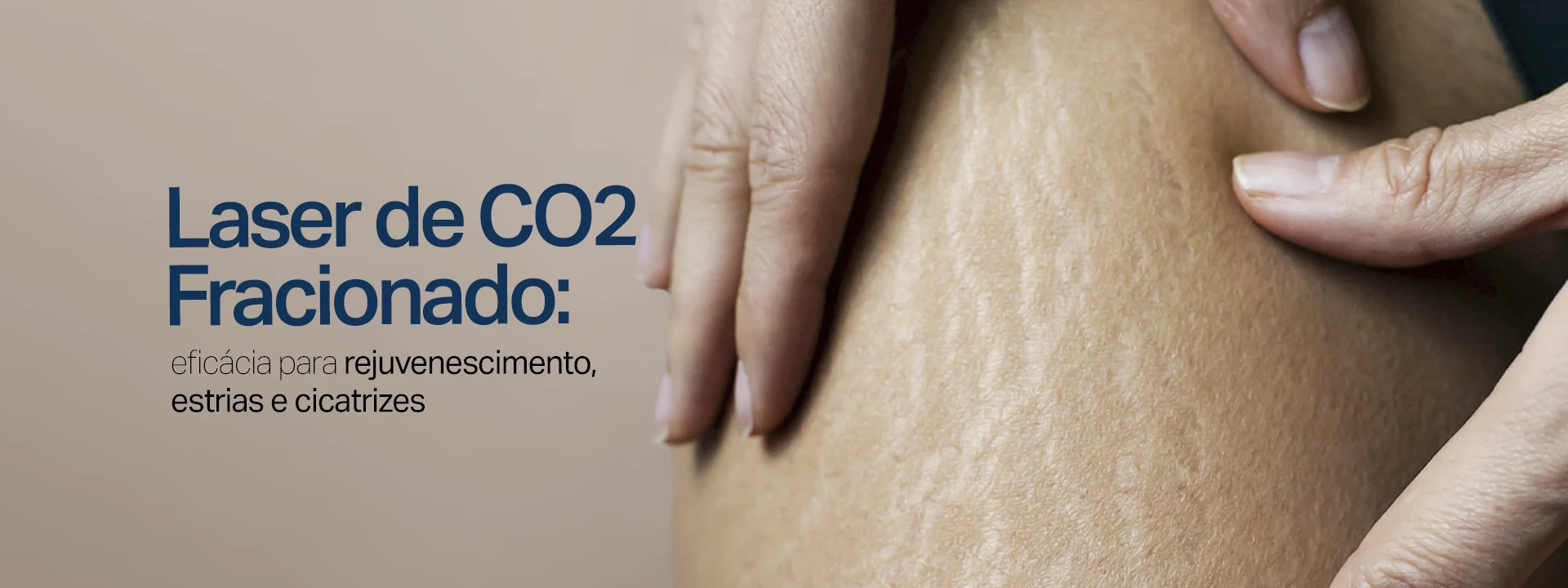 Sumaya Máttar Dermatologista - Juiz de Fora, MG - Tratamento Laser CO2 Fracionado