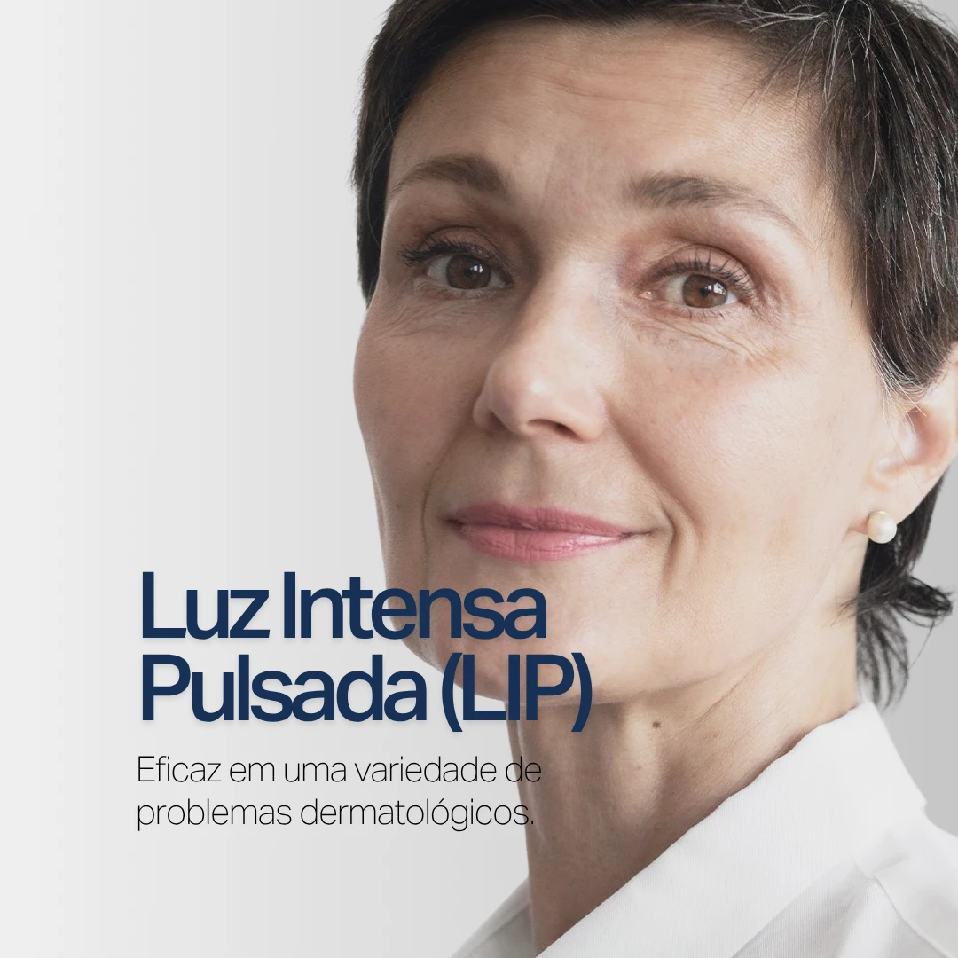 Sumaya Máttar Dermatologista - Juiz de Fora, MG - Tratamento Luz Intensa Pulsada (LIP)