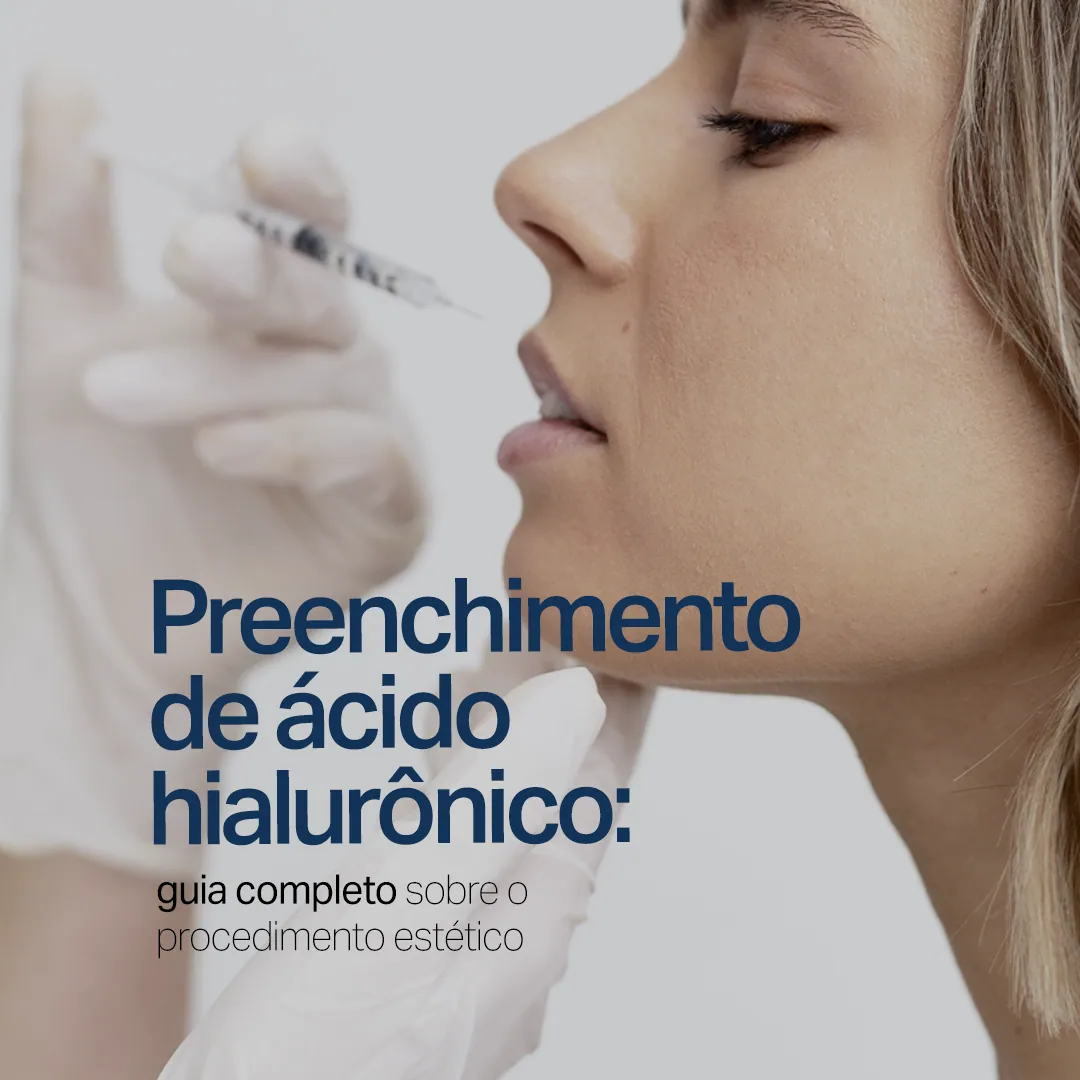 Sumaya Máttar Dermatologista - Juiz de Fora, MG - Tratamento Preenchimento de Ácido Hialurônico